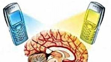 Ilustrasi radiasi ponsel terhadap otak