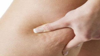 Tanpa Obat! Ini Cara Menghilangkan Selulit Secara Alami yang Terbukti Efektif