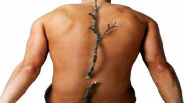 Ilustrasi Osteoporosis