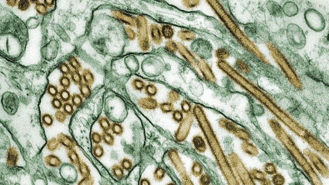 Virus H5N1 atau flu burung