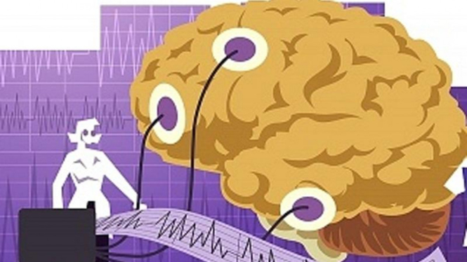 Ilustrasi Epilepsi.