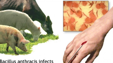 Virus Anthrax