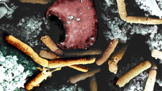 What to Know About Anthrax: a Disease from Animals Hit Humans