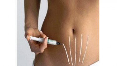 menghilangkan stretch mark.