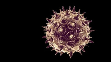 Ilustrasi virus.