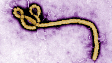 Ilustrasi virus.