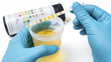 Urine baik untuk jerawat?