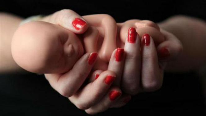 Ilustrasi aborsi.