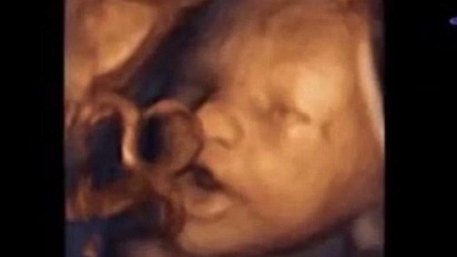 Bayi bernyanyi di dalam rahim