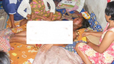 Korban yang dibakar suaminya di Palembang