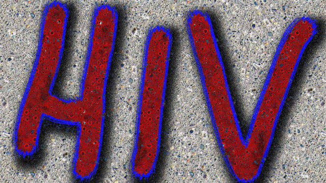 HIV