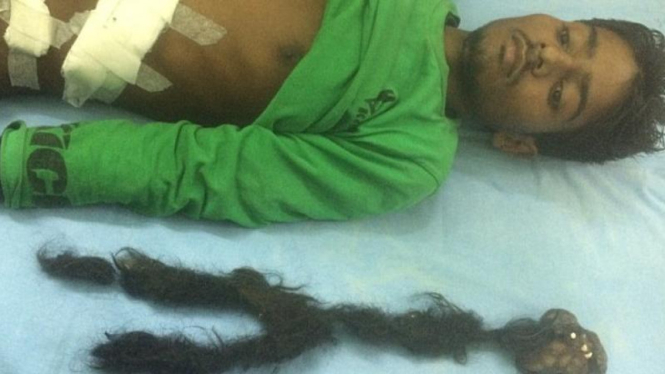 Narendra Kumar dan Parasit yang Ditemukan dalam tubuhnya