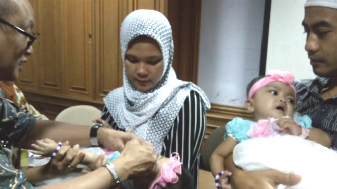Bayi kembar siam di RSCM