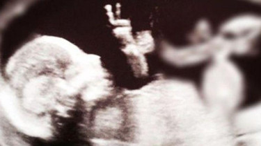  Foto USG calon bayi Janine dan Ryan Godfrey