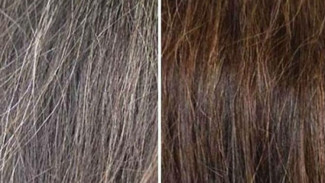 Ternyata 5 Hal Sepele Ini Bikin Rambut Cepat Beruban