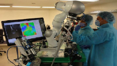 Robot bedah STAR