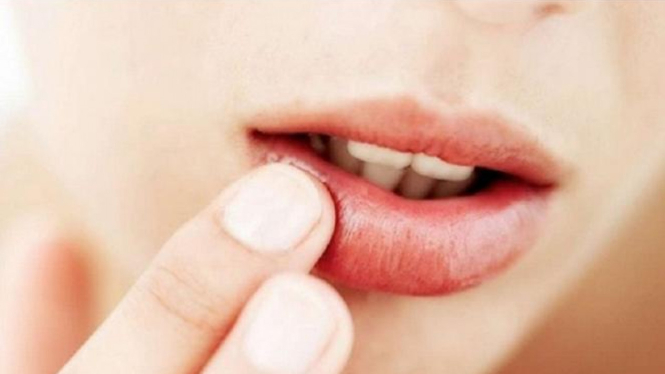 Ilustrasi bibir kering.