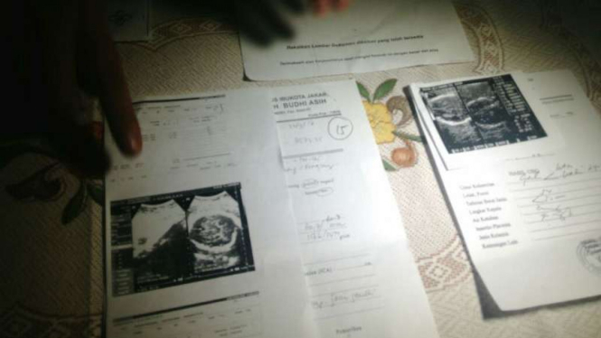 Hasil Ultrasonografi atau USG Raudiah Elva Ningsih dari RSUD Budhi Asih.