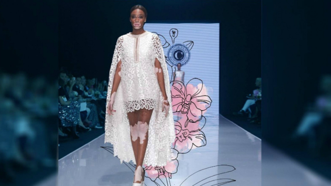 Winnie Harlow dalam balutan busana Sebastian Gunawan