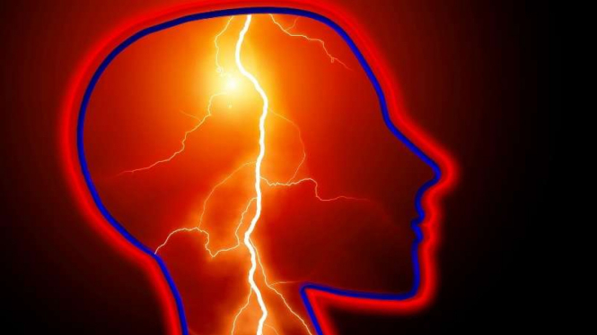 Ilustrasi stroke.