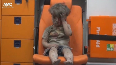 Omran Daqneesh, anak korban perang suriah