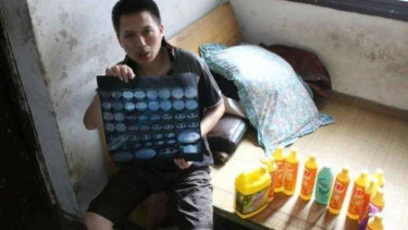Zhang saat menunjukkan hasil medis dirinya.