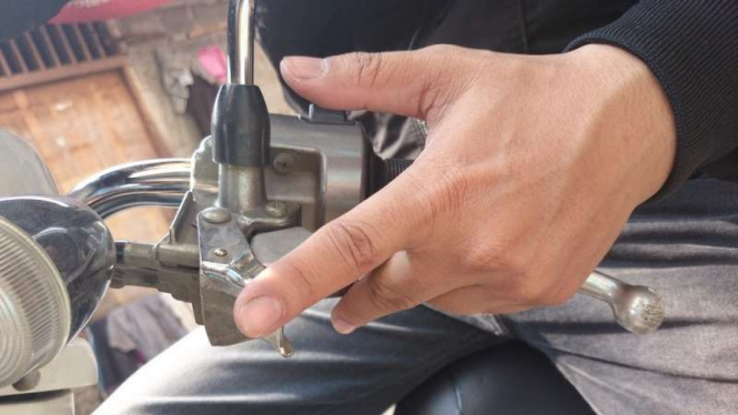 Rem tangan sepeda motor.