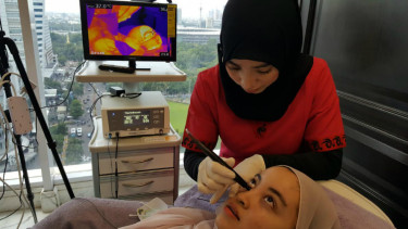 Pasien melakukan thermi smooth di area bawah mata.