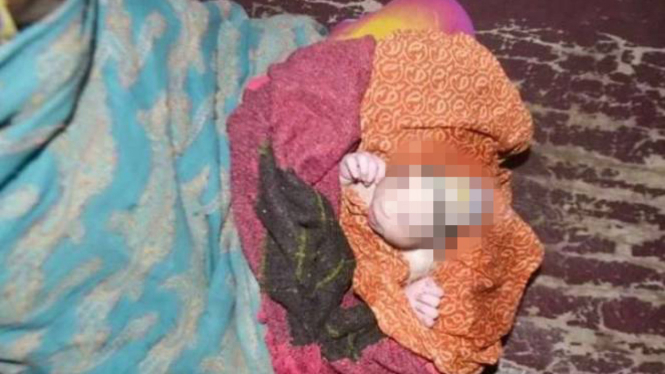 Bayi malang, ibunya menolak menyusui karena menganggap bayinya seperti alien.