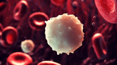 llustrasi kanker leukemia.