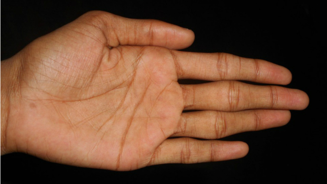 Telapak tangan.