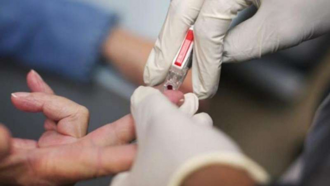 Terapi medis penderita stroke.