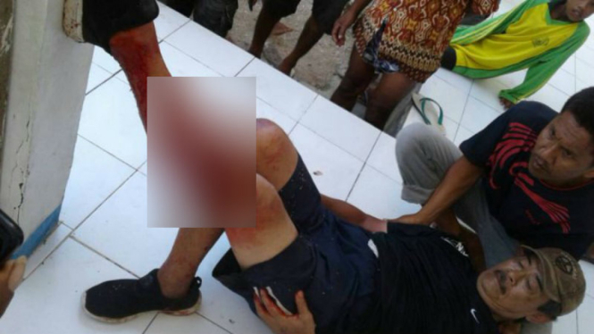Wisatawan asal Singapura luka parah digigit Komodo