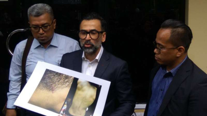 Jeremy Thomas Laporkan Oknum Polisi Penyiksa Anaknya