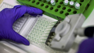 sampel lab - sel - laboratorium.