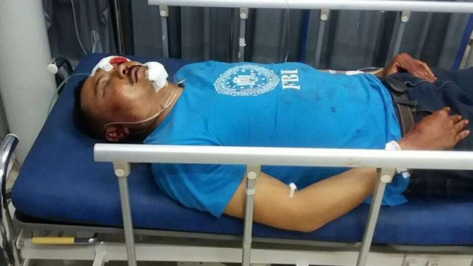 Brigadir Slamet luka-luka setelah dikeroyok.