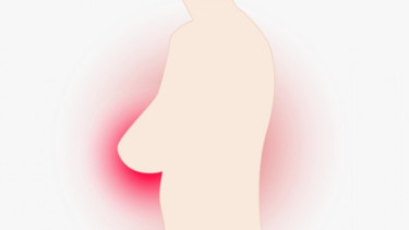 Ilustrasi payudara.