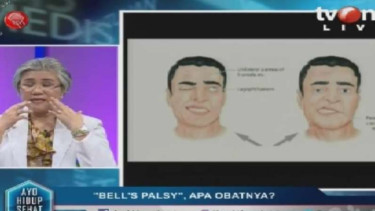 Ayo Hidup Sehat (Bells Palsy)