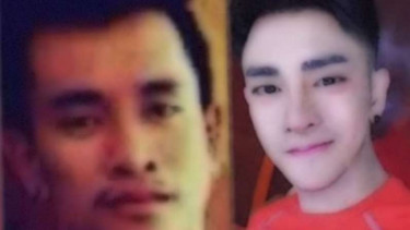 Pria Thailand ini ketagihan operasi plastik