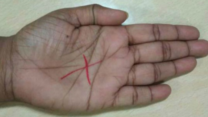 Huruf 'X' di telapak tangan.