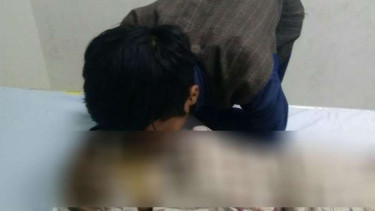 Jasad balita di Bekasi yang diduga menjadi korban penganiayaan orangtuanya.