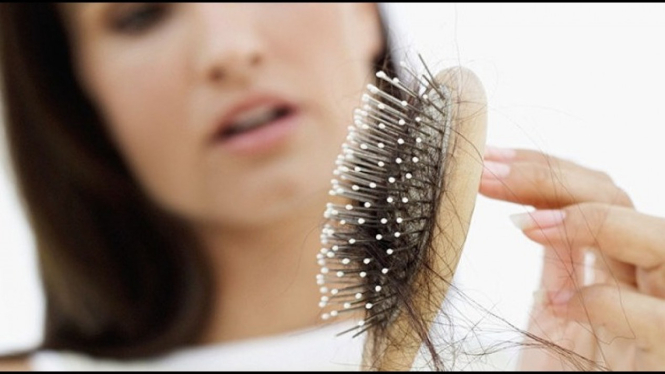 Ilustrasi rambut rontok.