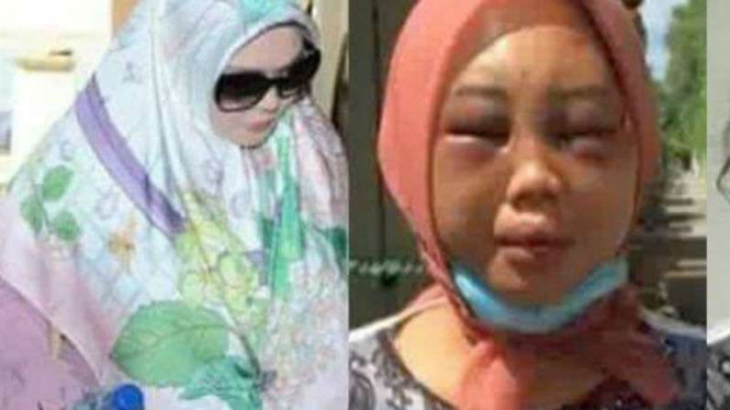 Datin Rozita (kiri) siksa brutal TKI Suyanti (kanan)