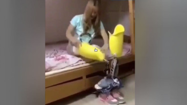 Wanita jalani hidup tanpa kaki.