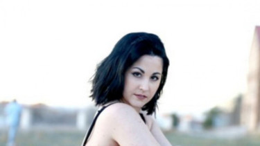 Celia Martinez model dengan psoriasis
