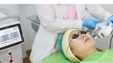 Perawatan Photo Facial