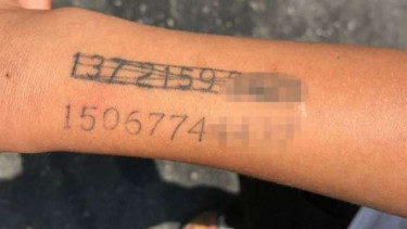 Tato nomor telepon di lengan anak keterbelakangan mental 