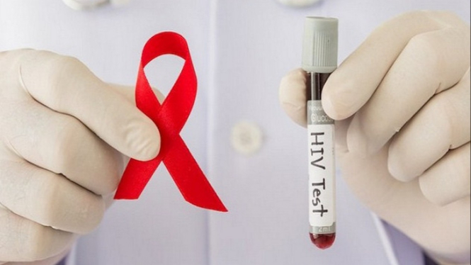 Hasil tes HIV.