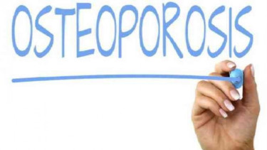 Penyakit osteoporosis.