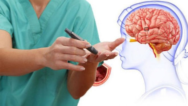 Ilustrasi stroke.